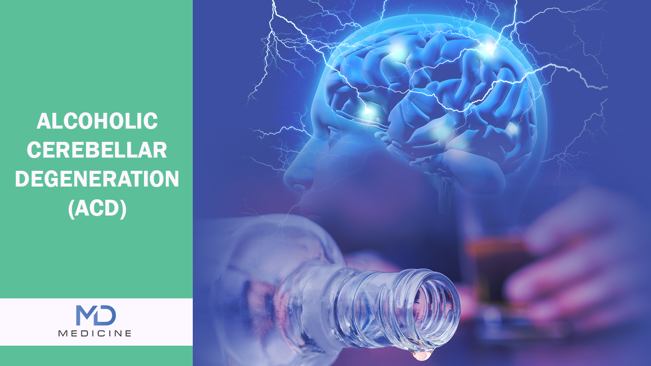 Alcoholic Cerebellar Degeneration (ACD)