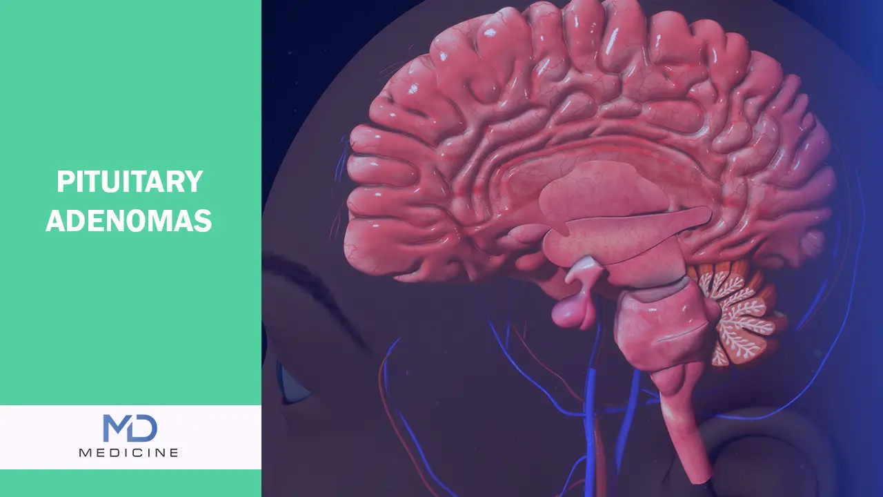 Pituitary Adenomas