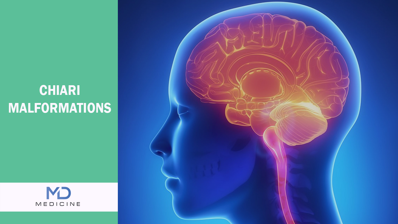 Chiari Malformations