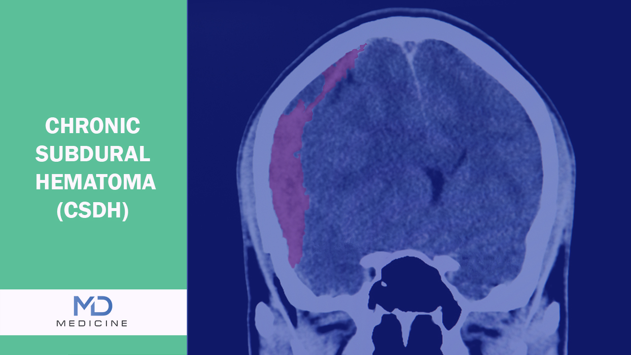 Chronic Subdural Hematoma (CSDH)?