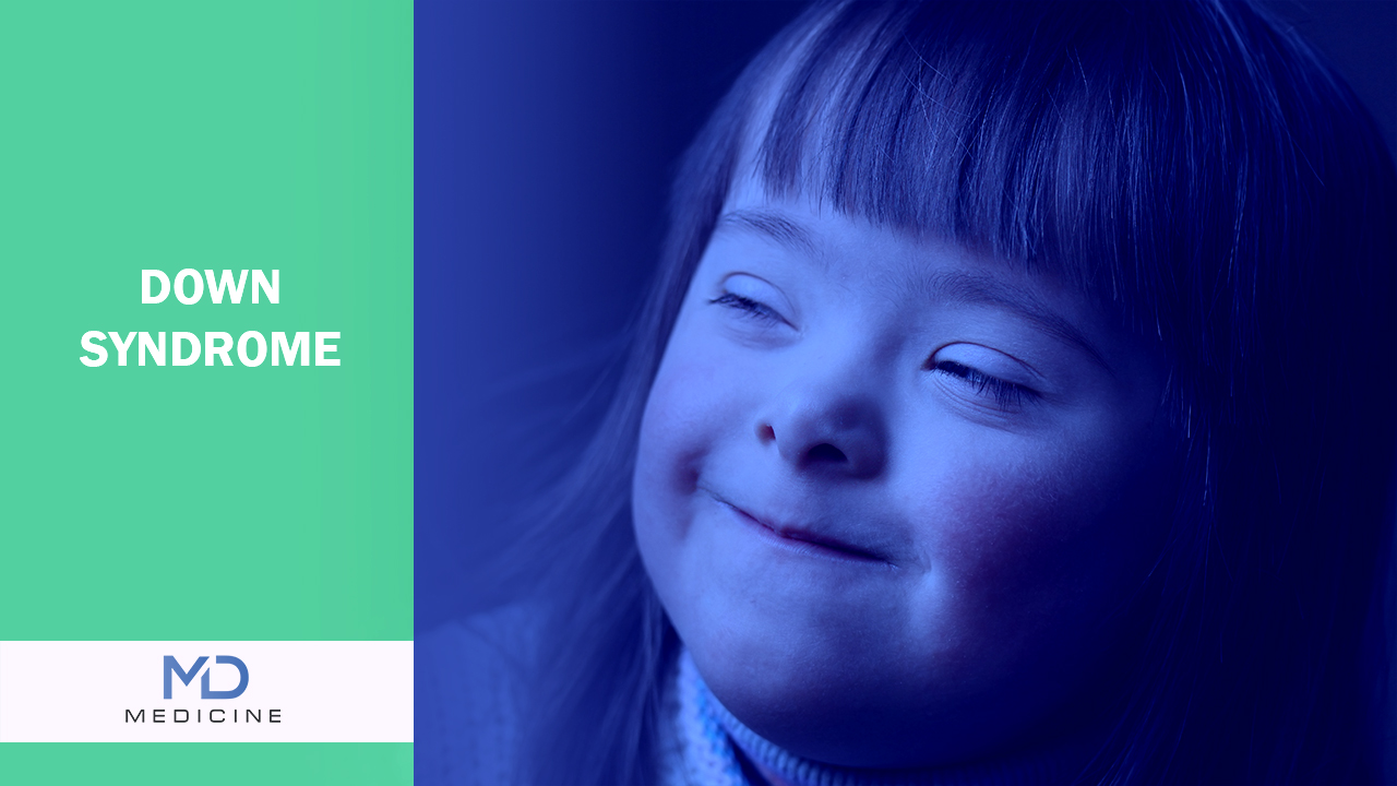 Down’s syndrome