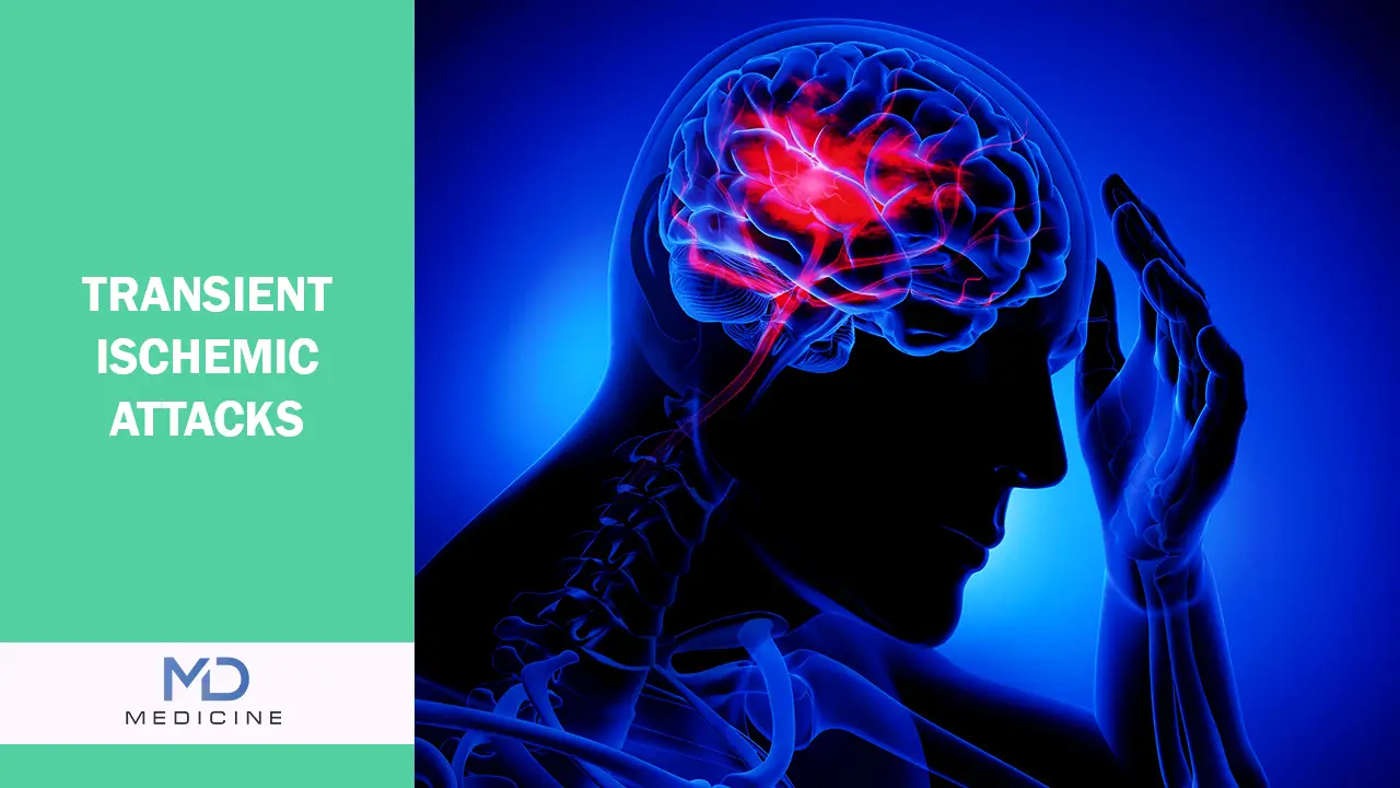 Transient Ischemic Attacks (TIAs)